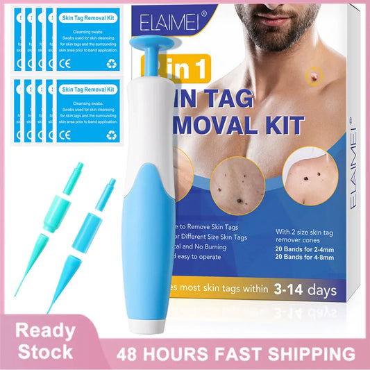 ShopGlobalTrends™ 2-in-1 Skin Tag Remover Kit