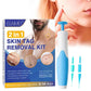 ShopGlobalTrends™ 2-in-1 Skin Tag Remover Kit