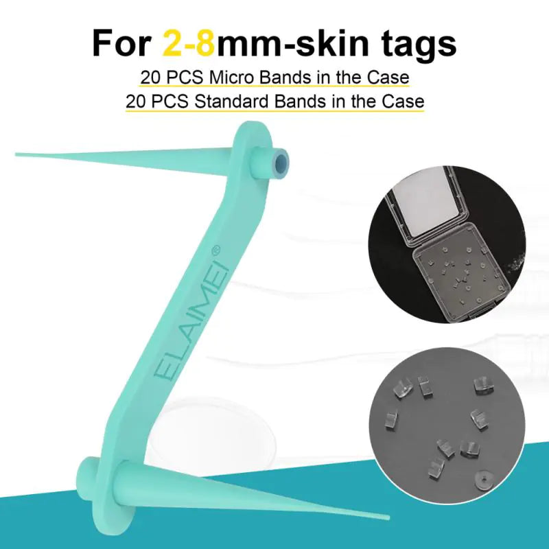 ShopGlobalTrends™ 2-in-1 Skin Tag Remover Kit